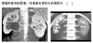 2013年高級衛生專業技術資格考試 放射醫學練習題及答案（1月6日放射衛生技術服務專題）